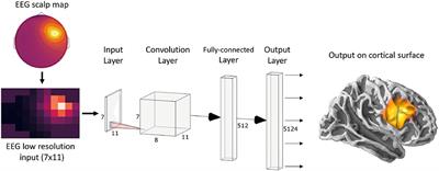 ConvDip: A Convolutional Neural Network for Better EEG Source Imaging